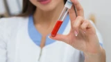 Густая кровь после 50: 5 продуктов-разжижителей — предотвратят образование тромбов