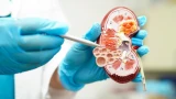 Почки кричат о помощи: 7 привычек, которые их убивают