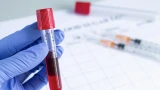 Осторожно: эти продукты делают кровь гуще
