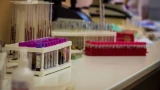 Жителям Мурманской области напомнили, как избежать заражения ВИЧ