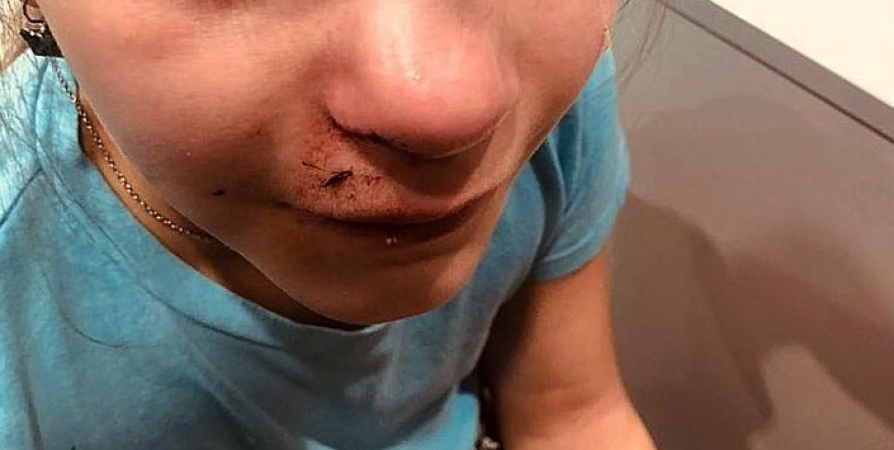 В Мурманске 9-летняя девочка сломала нос в детском парке развлечений