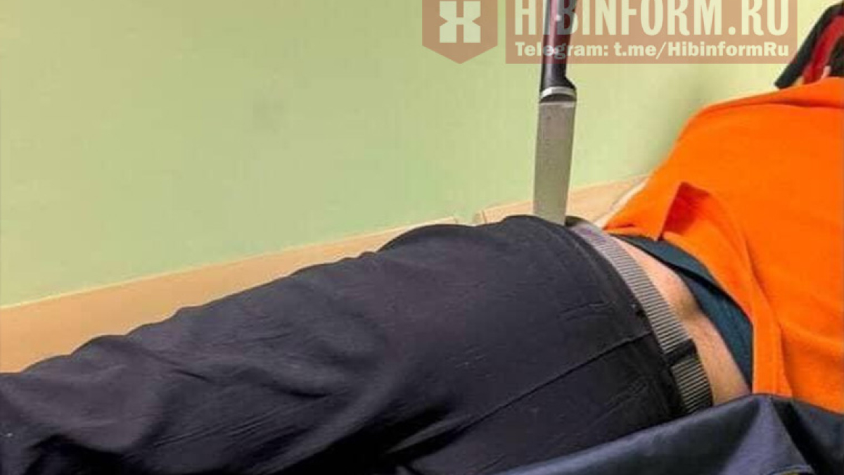 Мужчина с ножом в ягодице