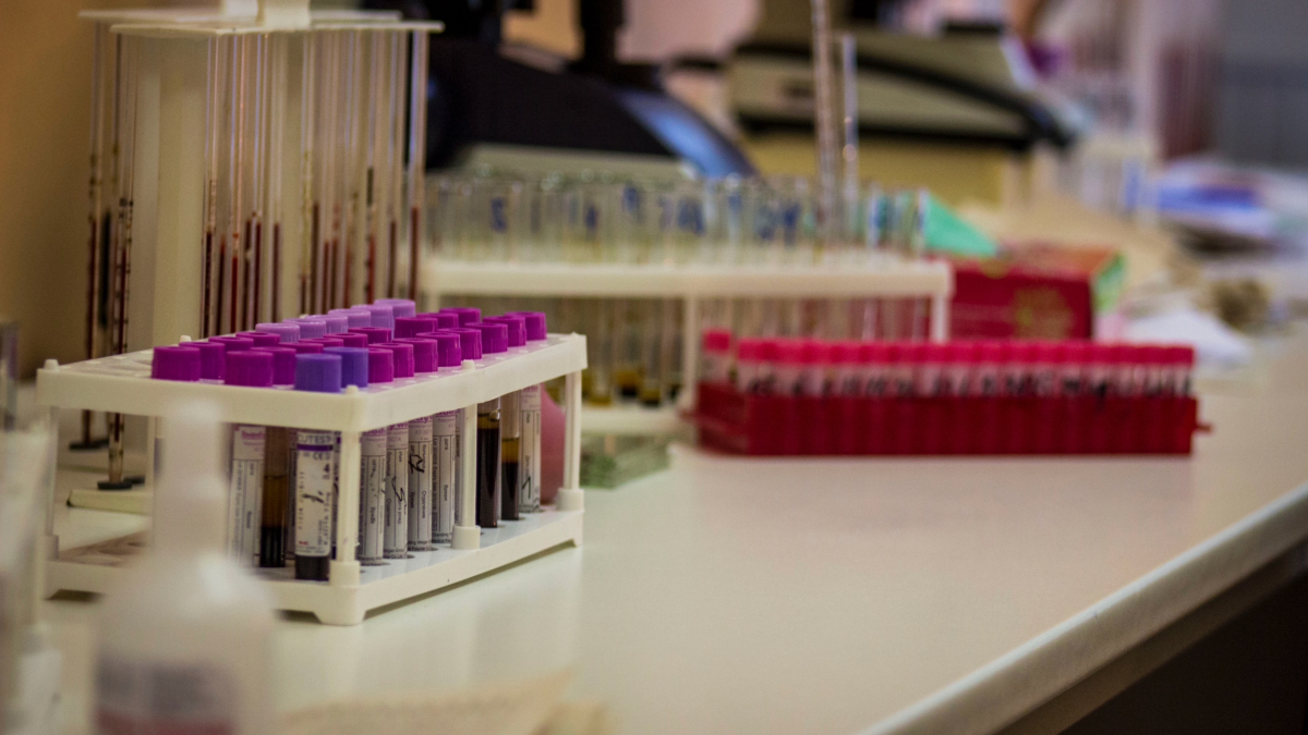 Кровь в пробирках