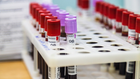 пробирки с кровью