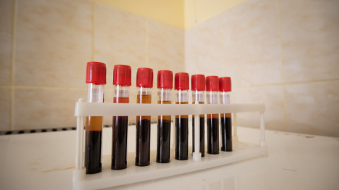 Образцы крови в пробирках