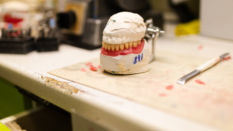 Слепок зубов